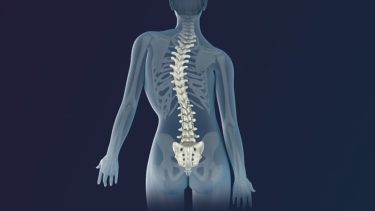 脊椎側弯症(Scoliosis)