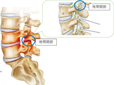 椎間関節（関節包）由来の腰痛
